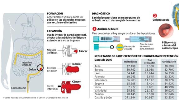 Cancer de colon sintomas fotos